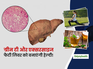 फैटी लिवर को हेल्दी लिवर में बदल सकते हैं ग्रीन टी और एक्सरसाइज बस जान लें ये तरीकाः शोध